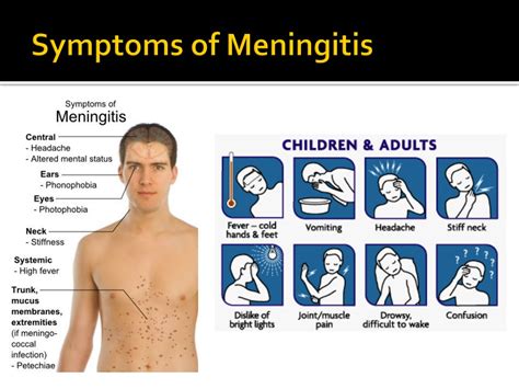 spinal meningitis symptoms